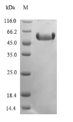 SDS-PAGE - Recombinant Mouse CTGF protein (Tagged) (AB235674)