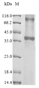 SDS-PAGE - Recombinant Mouse Cxcr2 Protein (His Tag) (AB314622)