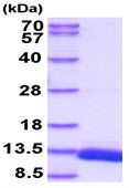 SDS-PAGE - Recombinant Mouse DBI protein (His tag N-Terminus) (AB229507)
