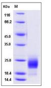 SDS-PAGE - Recombinant Mouse DCL-1 protein (His tag) (AB276909), expandable thumbnail