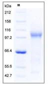 SDS-PAGE - Recombinant Mouse DDR2 protein (His tag) (AB276868)