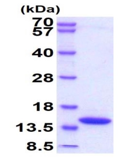 Recombinant Mouse DDT protein (His tag)