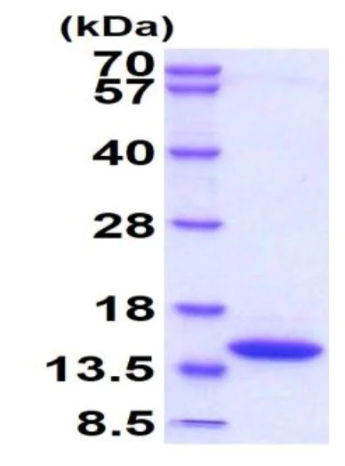 SDS-PAGE - Recombinant Mouse DDT protein (His tag) (AB229365)