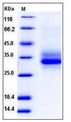 SDS-PAGE - Recombinant Mouse Dectin-1 protein (His tag) (AB276797)