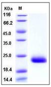 SDS-PAGE - Recombinant Mouse DECTIN 2 protein (His tag) (AB276804), expandable thumbnail