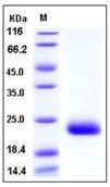SDS-PAGE - Recombinant Mouse DECTIN 2 protein (His tag) (AB276804)