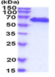 SDS-PAGE - Recombinant Mouse DLL4 protein (His tag) (AB208307)