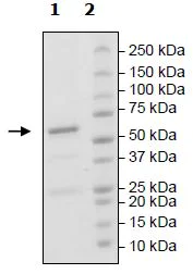 SDS-PAGE - Recombinant mouse DRAK2 protein (Active) (AB271491)