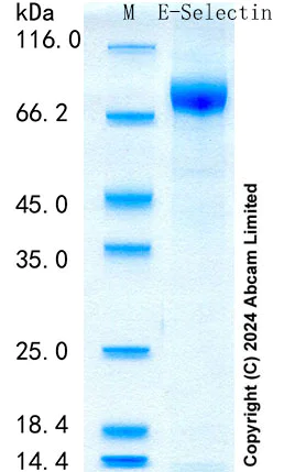 SDS-PAGE - Recombinant Mouse E-Selectin Protein Standard (AB316712)