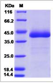 SDS-PAGE - Recombinant Mouse EGFL6 protein (His tag) (AB277002)