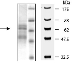 SDS-PAGE - Recombinant mouse EGFR protein (Active) (AB196107), expandable thumbnail