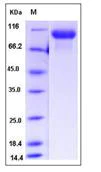 SDS-PAGE - Recombinant mouse EGFR protein (His tag) (AB276974)