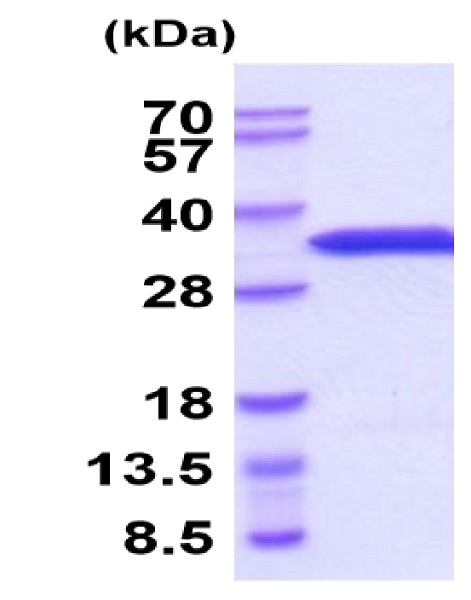 Recombinant Mouse eIF4E protein (His tag)
