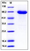 SDS-PAGE - Recombinant mouse Eph receptor A6 protein (His tag) (AB276886), expandable thumbnail