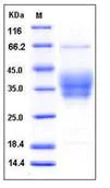 SDS-PAGE - Recombinant mouse Ephrin B2 protein (His tag) (AB276883)