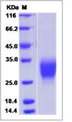 SDS-PAGE - Recombinant mouse EPO protein (AB276979)