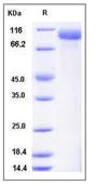 SDS-PAGE - Recombinant mouse ErbB3 / HER3 protein (His tag) (AB276962)