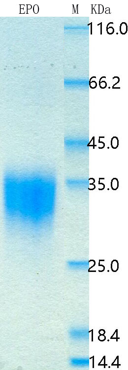 Recombinant Mouse Erythropoietin Protein Standard (His tag)