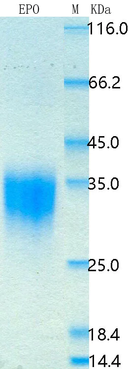 SDS-PAGE - Recombinant Mouse Erythropoietin Protein Standard (His tag) (AB316420)
