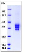 SDS-PAGE - Recombinant Mouse ESAM protein (His tag) (AB276956), expandable thumbnail