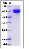 SDS-PAGE - Recombinant Mouse EWI-2 protein (His tag) (AB276967)