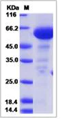 SDS-PAGE - Recombinant Mouse Factor H protein (His tag) (AB276997)