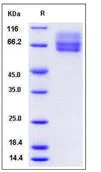 SDS-PAGE - Recombinant Mouse Factor IX/PTC protein (His tag) (AB276824)