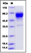 SDS-PAGE - Recombinant mouse Factor VII protein (His tag) (AB276751)