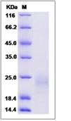 SDS-PAGE - Recombinant Mouse FAM3D protein (His tag) (AB276947), expandable thumbnail