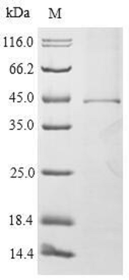 SDS-PAGE - Recombinant Mouse Fc epsilon RI/FCER1A protein (Tagged) (AB235018)