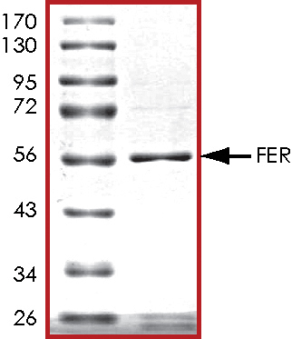 SDS-PAGE - Recombinant mouse FER protein (AB56258), expandable thumbnail