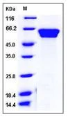 SDS-PAGE - Recombinant Mouse Fetuin B protein (His tag) (AB276878)