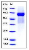 SDS-PAGE - Recombinant Mouse FGFRL1 protein (His tag) (AB276788)