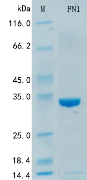 SDS-PAGE - Recombinant Mouse Fibronectin Protein Standard (His tag) (AB316379)