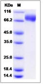 SDS-PAGE - Recombinant Mouse FLRT2 protein (His tag) (AB276972), expandable thumbnail