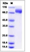SDS-PAGE - Recombinant Mouse FLRT2 protein (His tag) (AB276972)