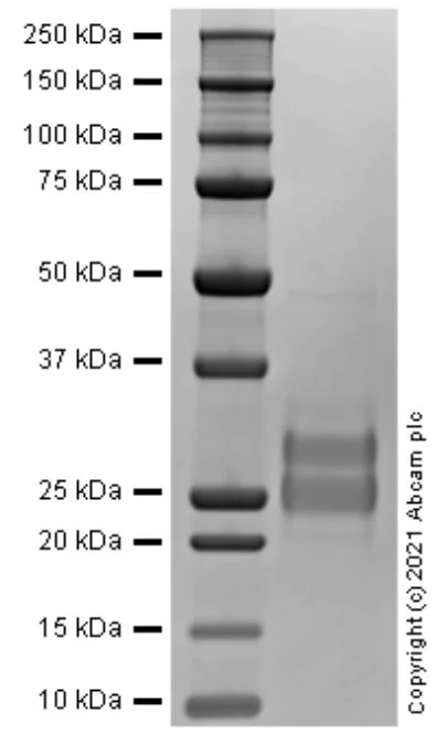 SDS-PAGE - Recombinant mouse Flt3 ligand/Flt3L protein (Active) (AB270071)