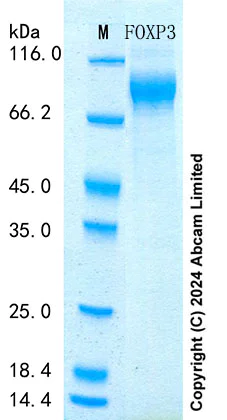 SDS-PAGE - Recombinant Mouse FOXP3 Protein Standard (His tag) (AB316680)