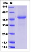 SDS-PAGE - Recombinant Mouse Frizzled 2/FZD2 protein (Fc Chimera) (AB276749), expandable thumbnail