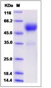 SDS-PAGE - Recombinant Mouse Frizzled 5 protein (Fc Chimera) (AB276925), expandable thumbnail