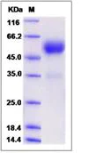 SDS-PAGE - Recombinant Mouse Frizzled 5 protein (Fc Chimera) (AB276925)
