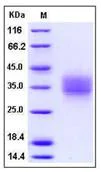 SDS-PAGE - Recombinant Mouse FZD1 protein (His tag) (AB276766)