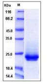SDS-PAGE - Recombinant Mouse FZD10 protein (His tag) (AB276876)