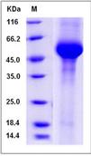 SDS-PAGE - Recombinant Mouse Galactosidase alpha protein (His tag) (AB276952), expandable thumbnail
