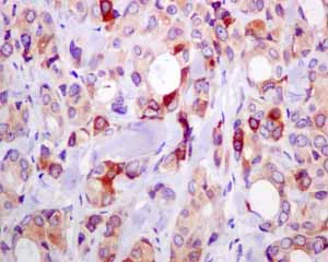 Immunohistochemistry (Formalin/PFA-fixed paraffin-embedded sections) - Recombinant Mouse Galectin 3 protein (AB137144)