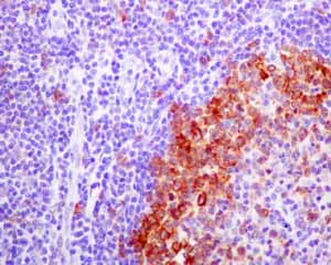 Immunohistochemistry (Formalin/PFA-fixed paraffin-embedded sections) - Recombinant Mouse Galectin 3 protein (AB137144)
