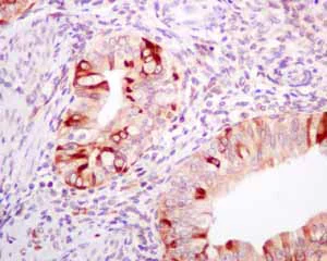 Immunohistochemistry (Formalin/PFA-fixed paraffin-embedded sections) - Recombinant Mouse Galectin 3 protein (His tag N-Terminus) (AB137144)