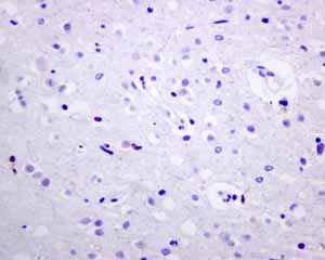 Immunohistochemistry (Formalin/PFA-fixed paraffin-embedded sections) - Recombinant Mouse Galectin 3 protein (His tag N-Terminus) (AB137144)