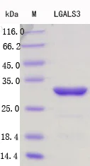 SDS-PAGE - Recombinant Mouse Galectin 3 Protein Standard (His tag) (AB316415)