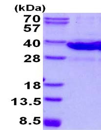 SDS-PAGE - Recombinant Mouse Galectin 8/Gal-8 protein (His tag N-Terminus) (AB134629)